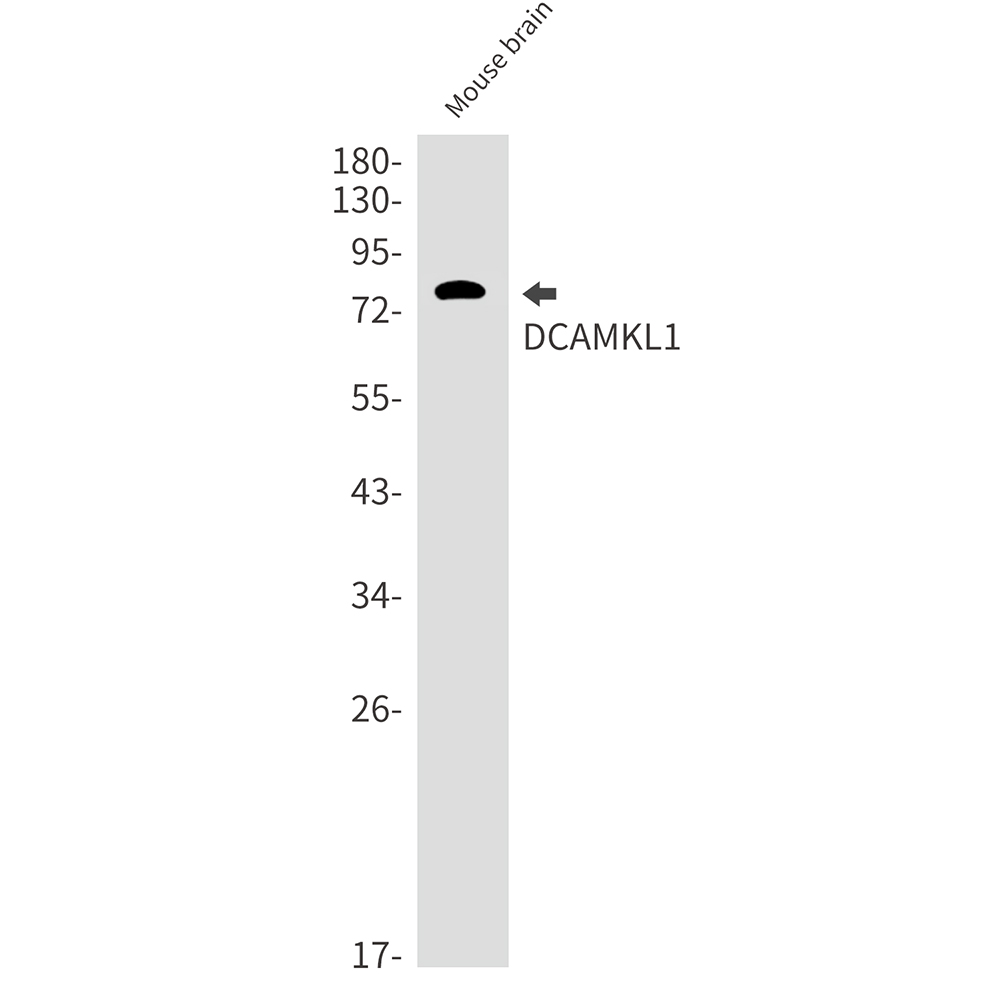Rabbit Monoclonal Antibody to DCAMKL1