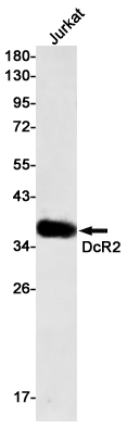 Rabbit Monoclonal Antibody to DcR2