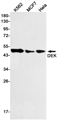 Rabbit Monoclonal Antibody to DEK