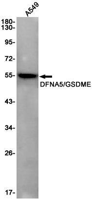 Rabbit Monoclonal Antibody to GSDME