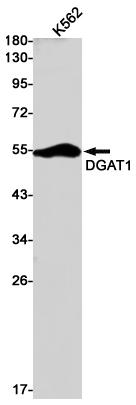 Rabbit Monoclonal Antibody to DGAT1
