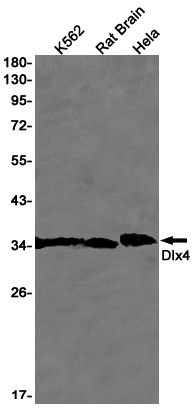 Rabbit Monoclonal Antibody to DLX4