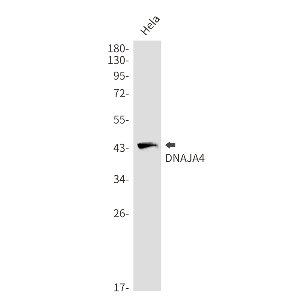Rabbit Monoclonal Antibody to DNAJA4