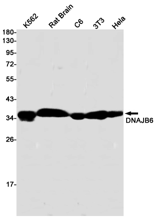 Rabbit Monoclonal Antibody to DNAJB6