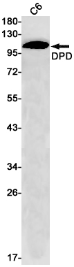 Rabbit Monoclonal Antibody to DPD