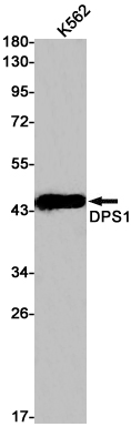 Rabbit Monoclonal Antibody to DPS1