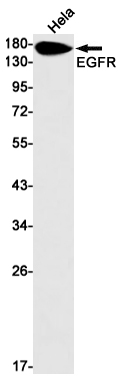 Rabbit Monoclonal Antibody to EGFR
