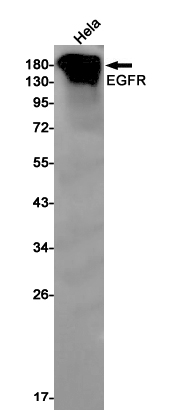 Rabbit Monoclonal Antibody to EGFR