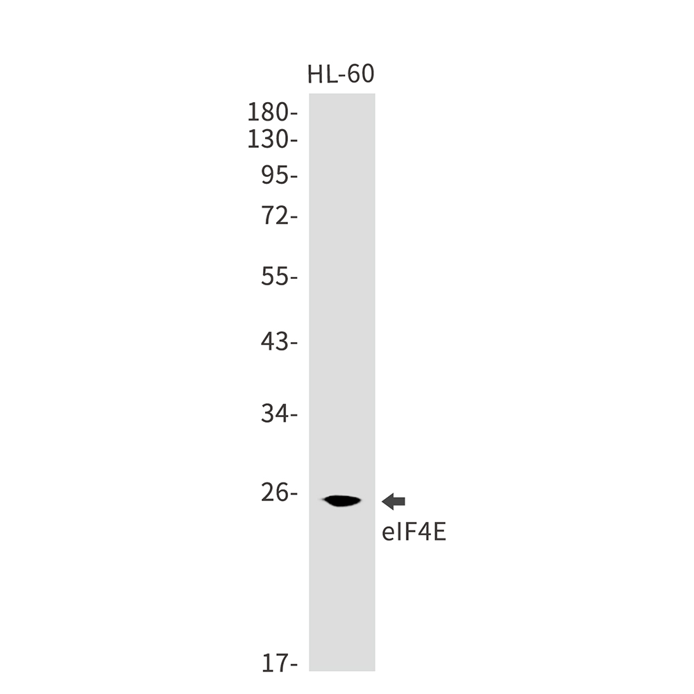 Rabbit Monoclonal Antibody to eIF4E