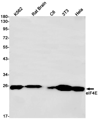 Rabbit Monoclonal Antibody to eIF4E