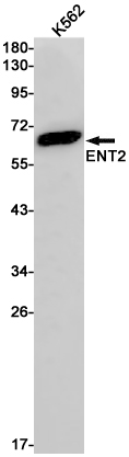 Rabbit Monoclonal Antibody to ENT2