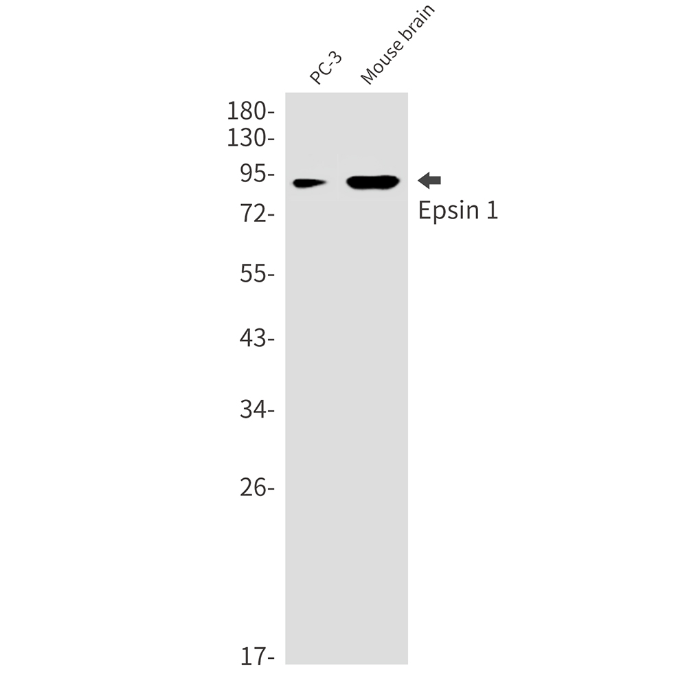 Rabbit Monoclonal Antibody to Epsin 1