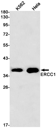 Rabbit Monoclonal Antibody to ERCC1