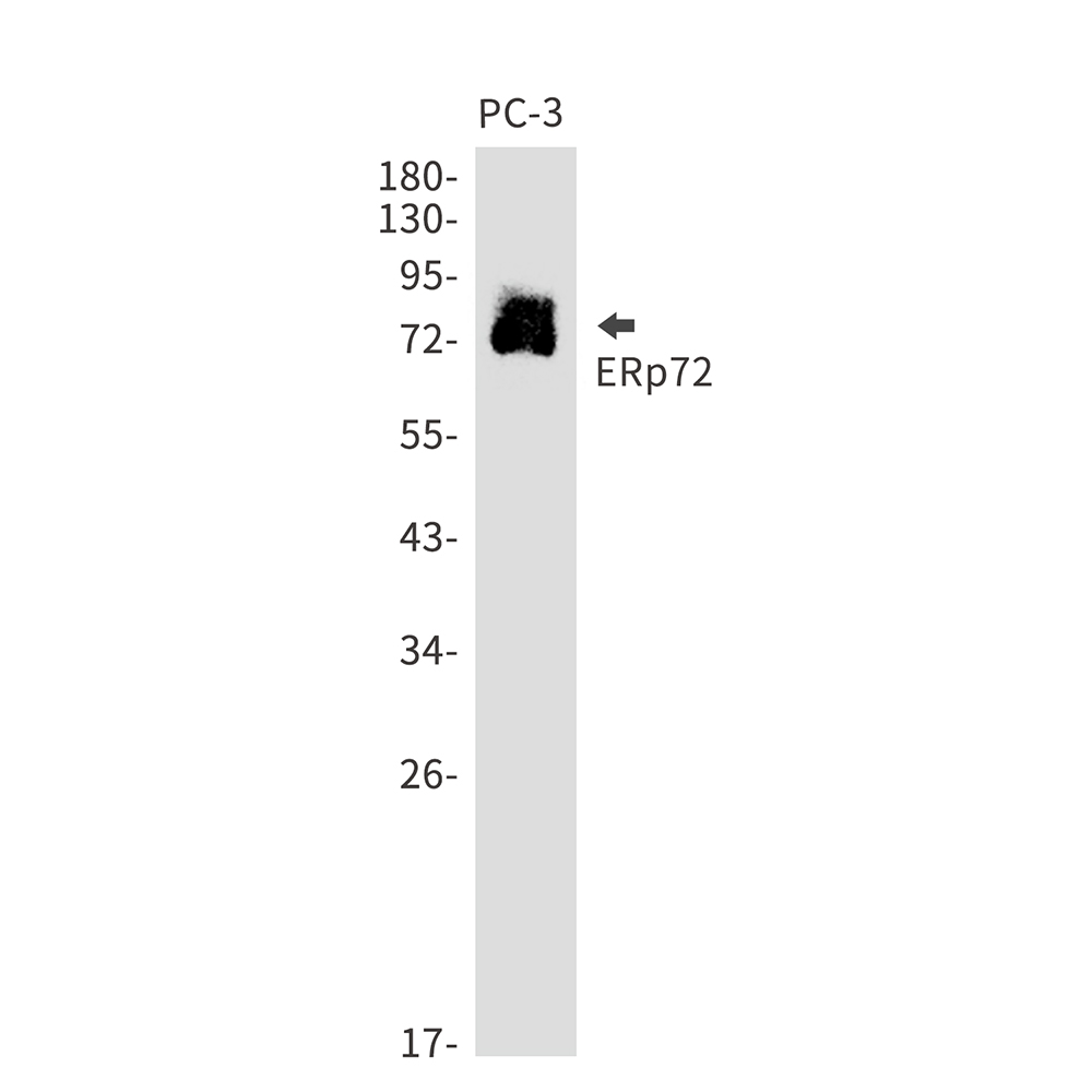 Rabbit Monoclonal Antibody to ERp72