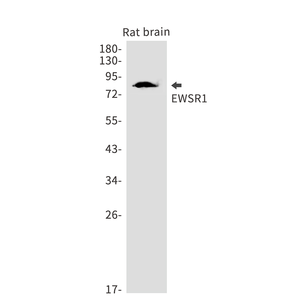 Rabbit Monoclonal Antibody to EWSR1