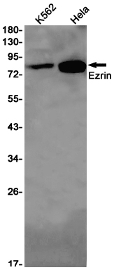 Rabbit Monoclonal Antibody to Ezrin