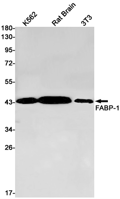 Rabbit Monoclonal Antibody to Aspartate Aminotransferase