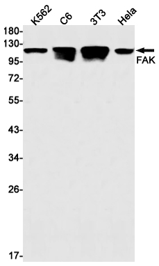 Rabbit Monoclonal Antibody to FAK