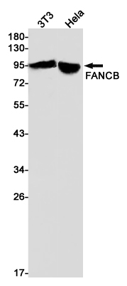 Rabbit Monoclonal Antibody to FANCB