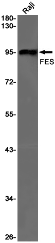 Rabbit Monoclonal Antibody to FES