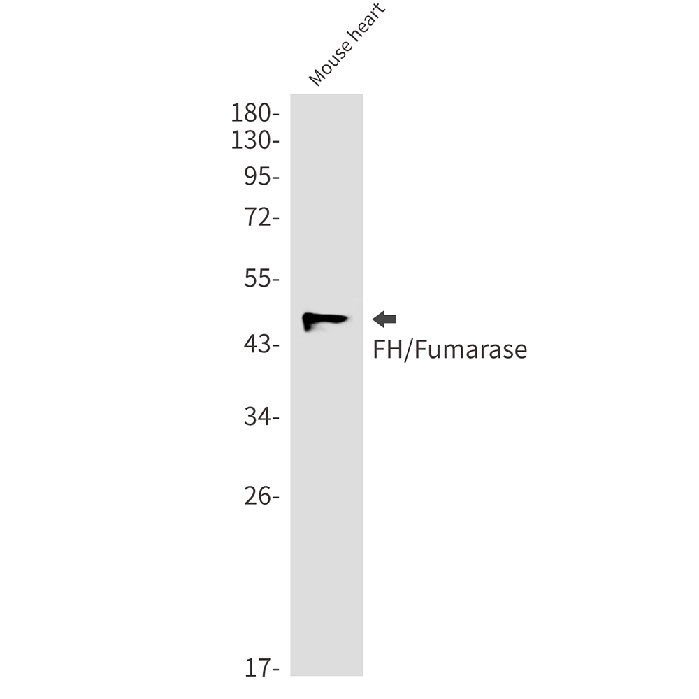 Rabbit Monoclonal Antibody to FH