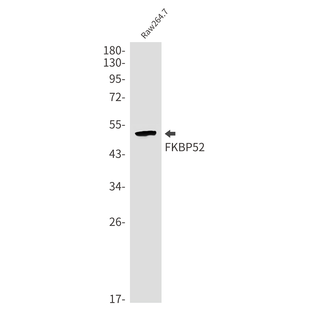 Rabbit Monoclonal Antibody to FKBP52