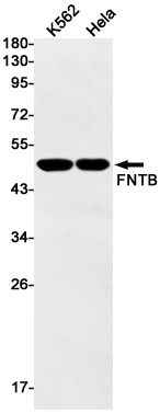 Rabbit Monoclonal Antibody to FNTB