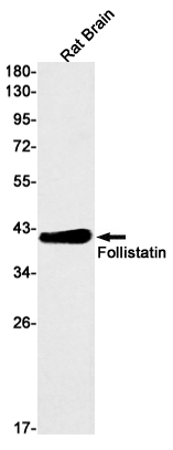 Rabbit Monoclonal Antibody to Follistatin