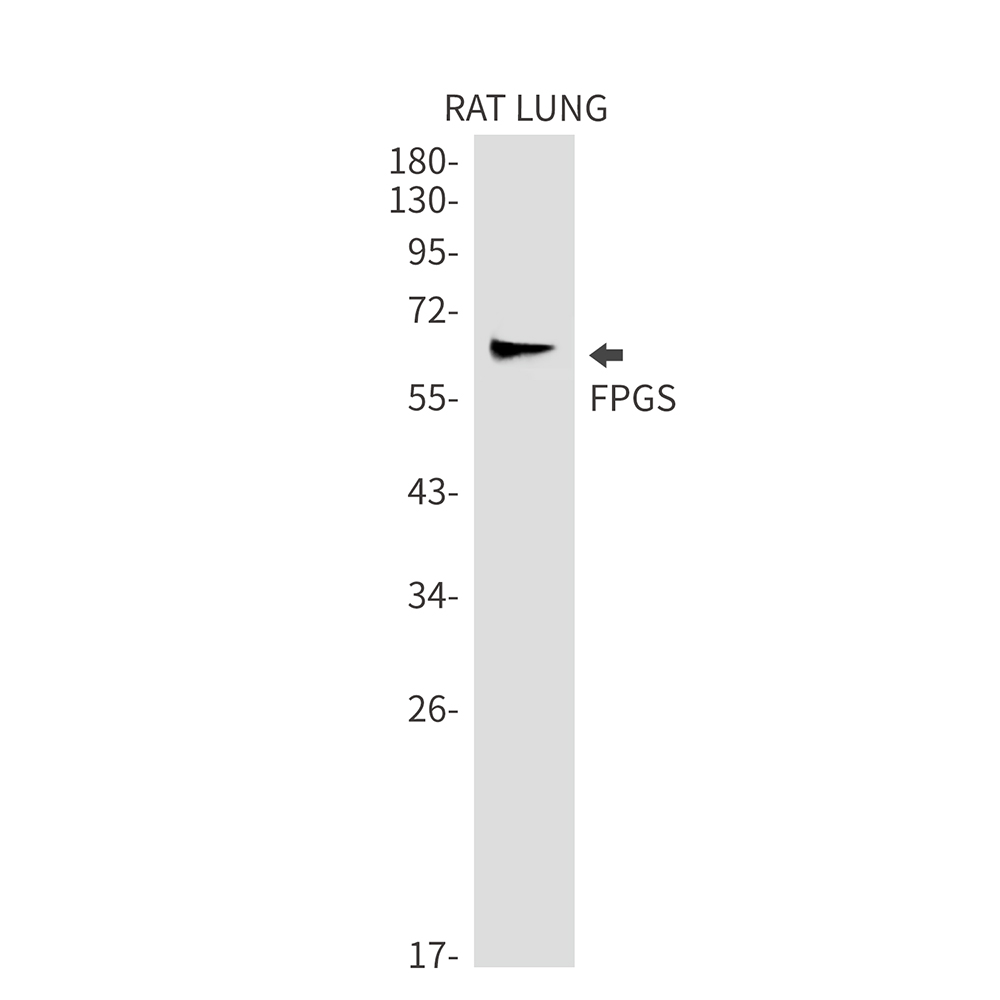 Rabbit Monoclonal Antibody to FPGS