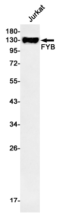 Rabbit Monoclonal Antibody to FYB