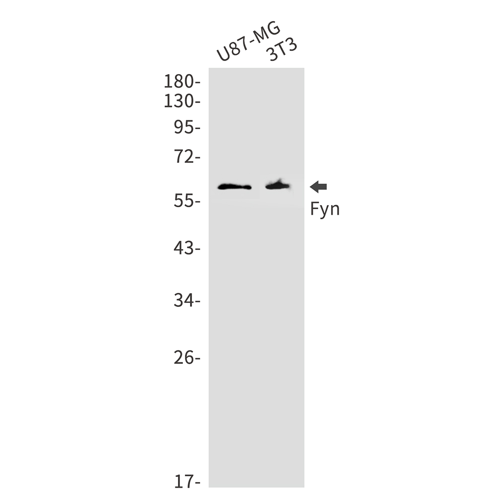 Rabbit Monoclonal Antibody to FYN