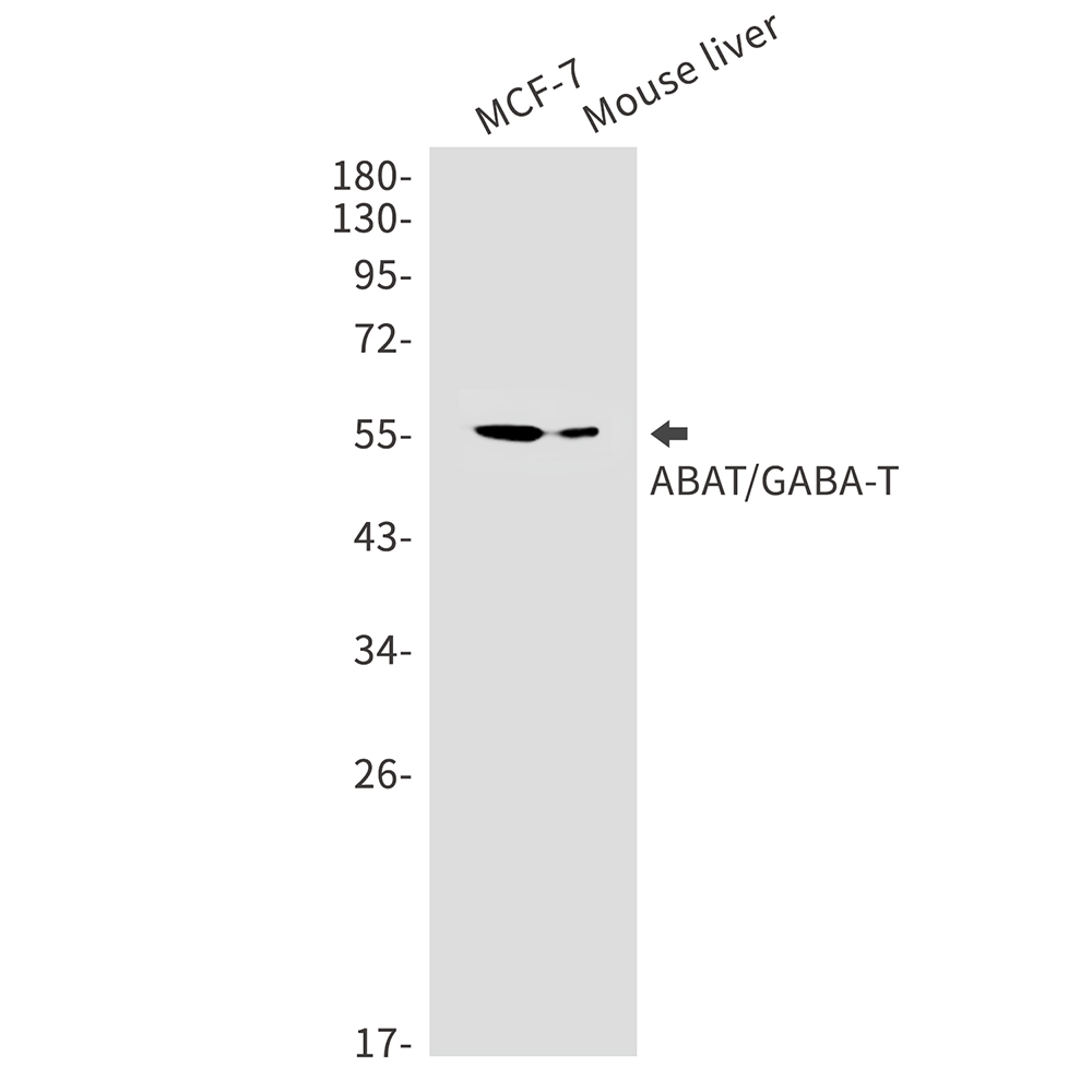 Rabbit Monoclonal Antibody to ABAT