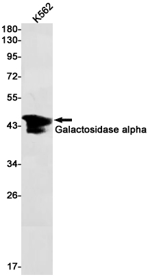 Rabbit Monoclonal Antibody to Galactosidase alpha