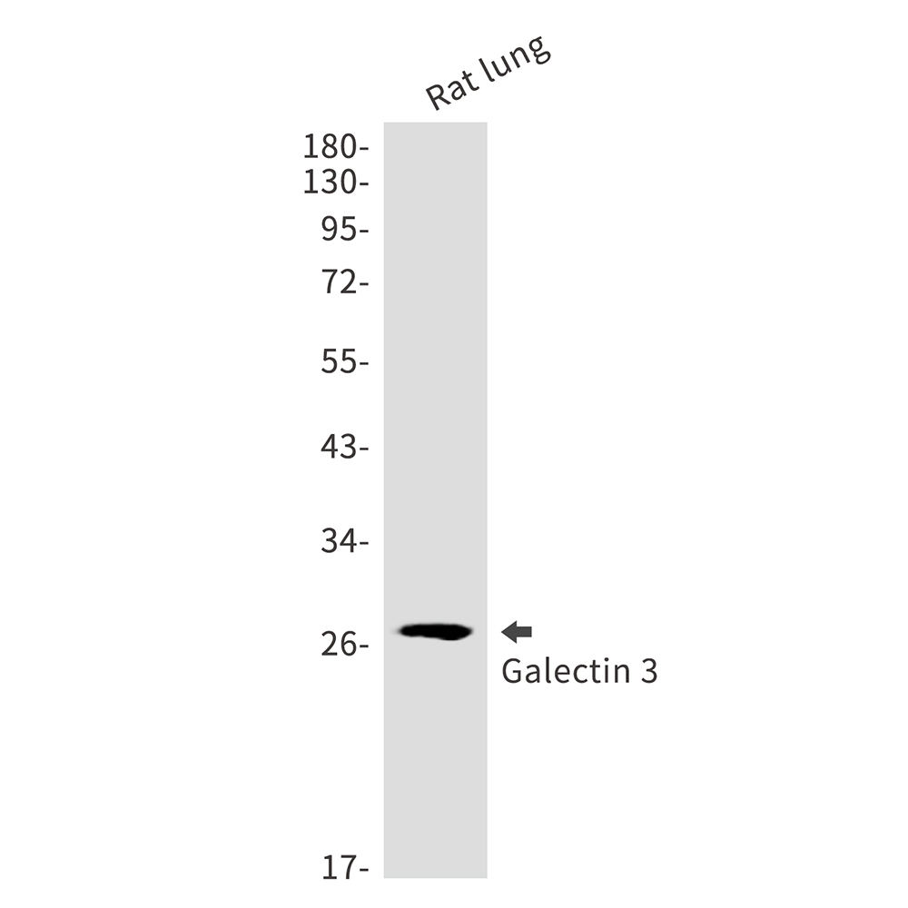 Rabbit Monoclonal Antibody to Galectin 3