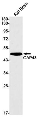 Rabbit Monoclonal Antibody to GAP43