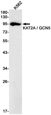 Rabbit Monoclonal Antibody to KAT2A