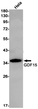 Rabbit Monoclonal Antibody to GDF15