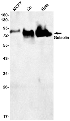 Rabbit Monoclonal Antibody to Gelsolin