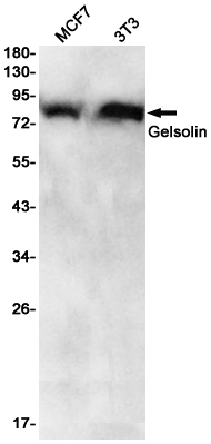 Rabbit Monoclonal Antibody to Gelsolin