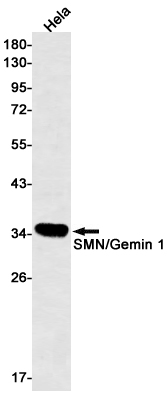 Rabbit Monoclonal Antibody to SMN