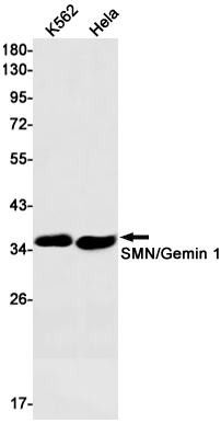 Rabbit Monoclonal Antibody to SMN