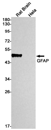Rabbit Monoclonal Antibody to GFAP