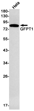 Rabbit Monoclonal Antibody to GFPT1