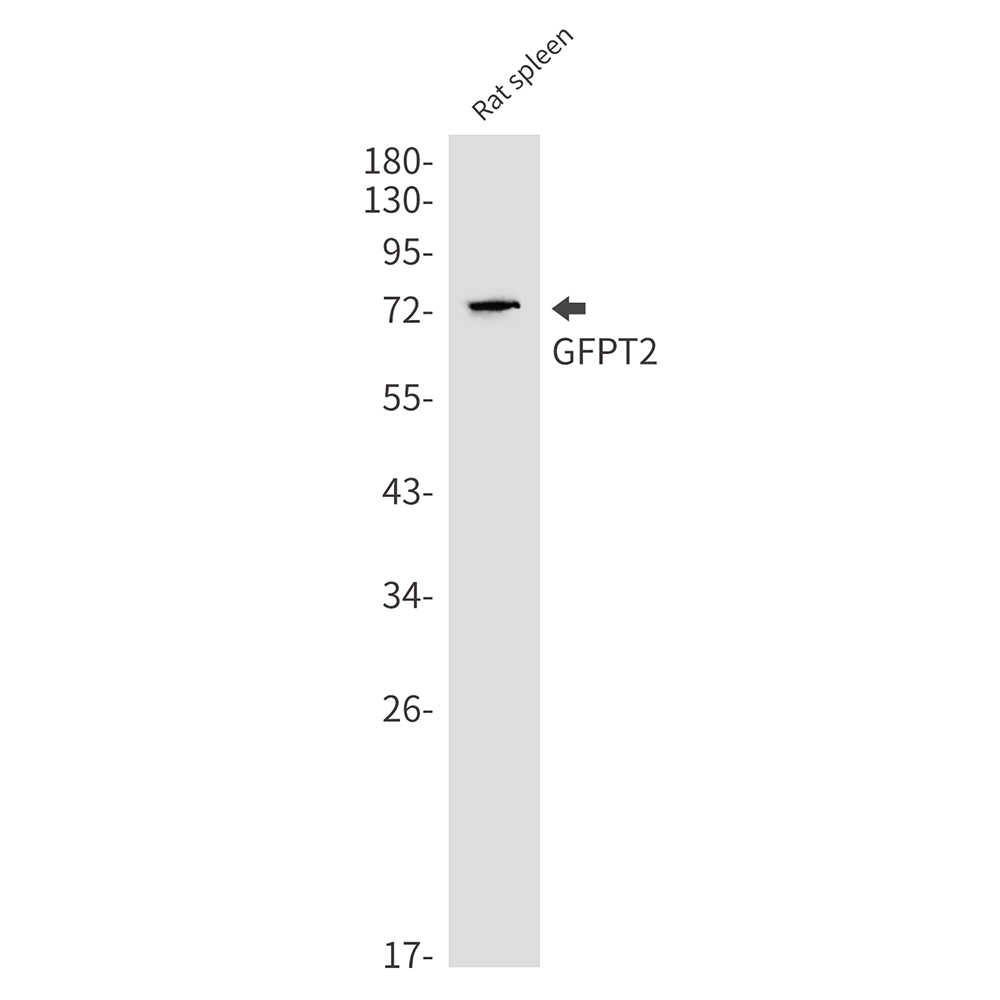 Rabbit Monoclonal Antibody to GFPT2