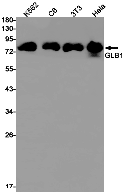 Rabbit Monoclonal Antibody to GLB1