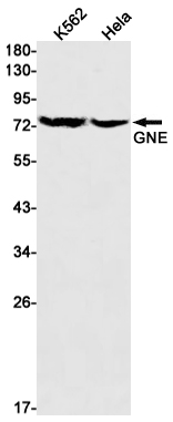 Rabbit Monoclonal Antibody to GNE