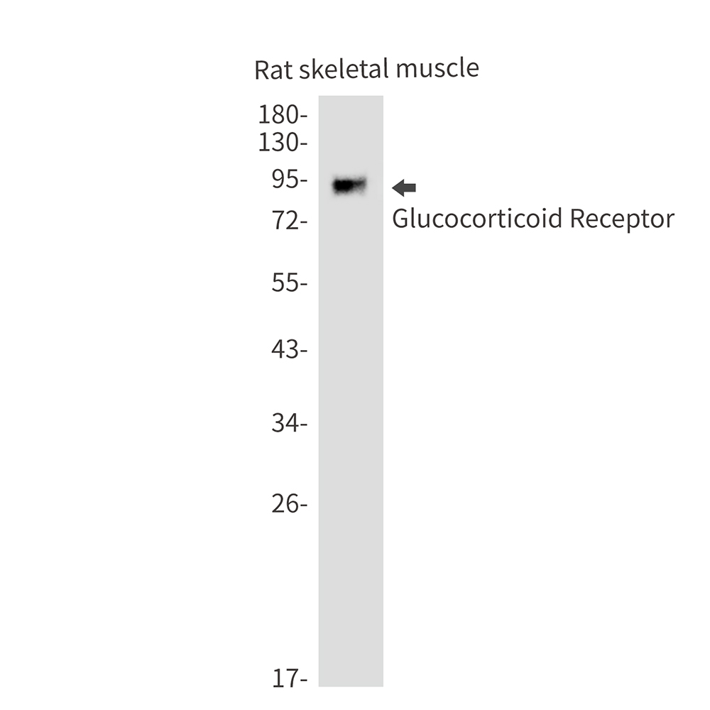Rabbit Monoclonal Antibody to Glucocorticoid Receptor