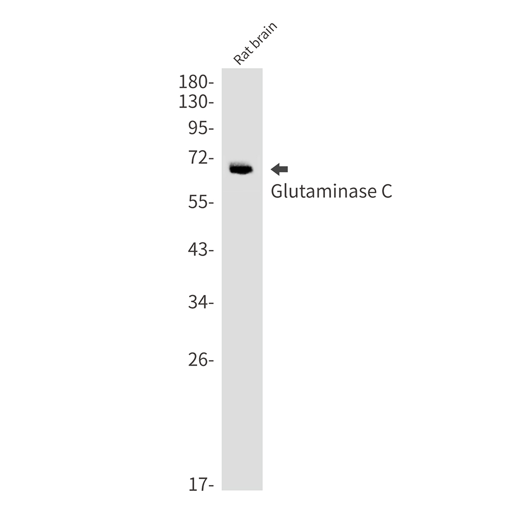 Rabbit Monoclonal Antibody to Glutaminase