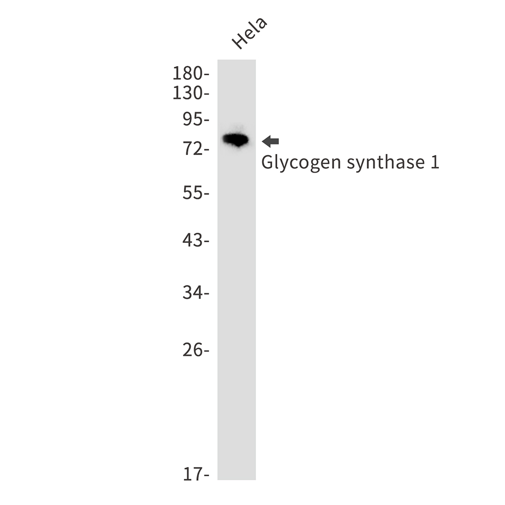 Rabbit Monoclonal Antibody to Glycogen Synthase 1