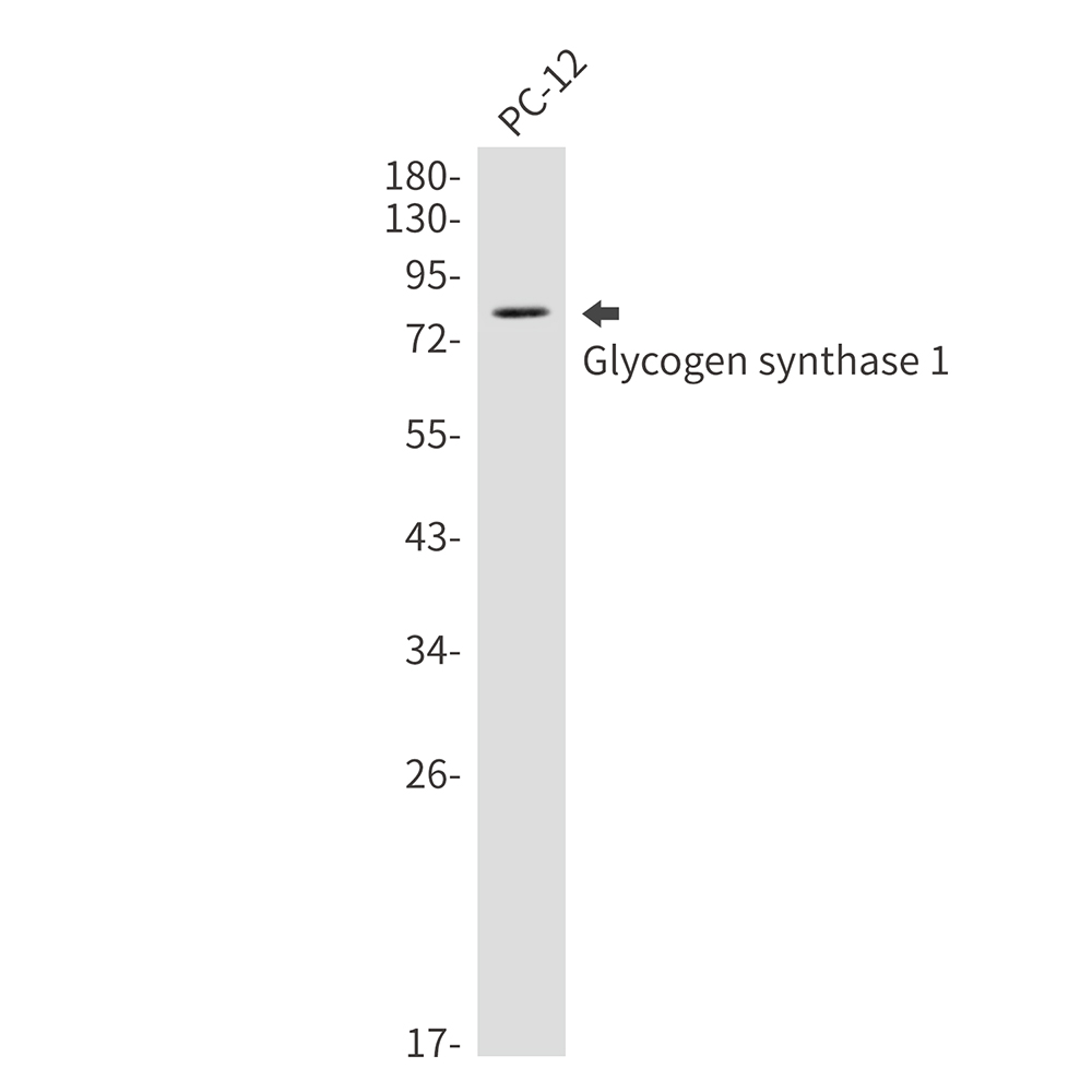Rabbit Monoclonal Antibody to Glycogen Synthase 1